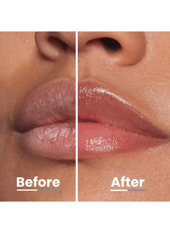 - Peach Lip Balm For Dry & Chapped Lips | Vitamin Infused Peptide | Hydrating & Moisturizing Balm For Men & Women | Hyphen Products | Lip Balm For Dark Lips | Smoothen Lips & Barrier Repair | Moisturizer For Dry Lips, Chapped Lips Winter | Vegan, Sls & Parabens Free | 10 Gm