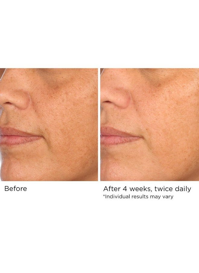 NassifMD Hydro-Screen - Clinical Grade Serum with Premium Ingredients: Ceramides, Retinol, Bakuchiol, Hyaluronic Acid - Anti Aging Treatment