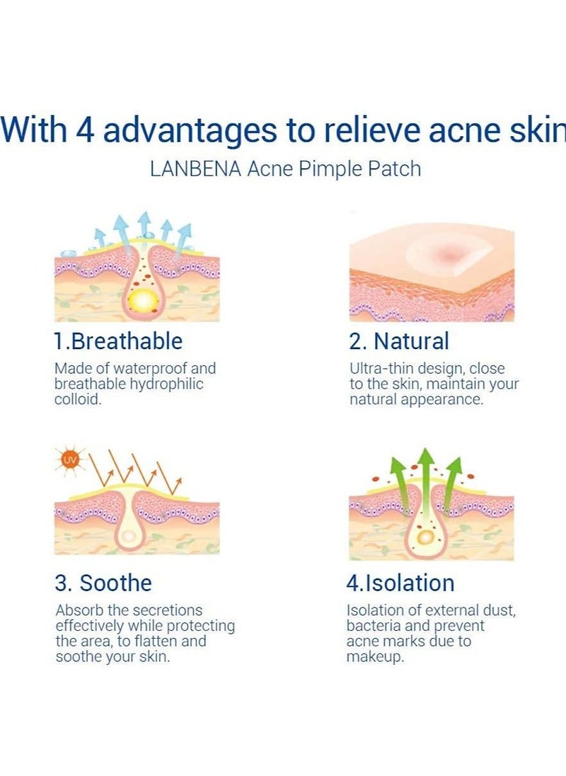 LANBENA Acne Pimple Patches 28 Patches Hydrophilic Acne Patch with Tea Tree Oil, Quick & Easy Acne Spot Treatment Acne Patches (Night use)