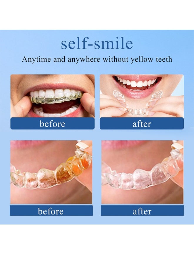 Retainer Cleaner，Retainer Cleaner Tablets Denture Cleaning Tablets for Dental Appliances and Night Mouth Guard Cleanser Removes Odors Stains Plaque-36Tablets