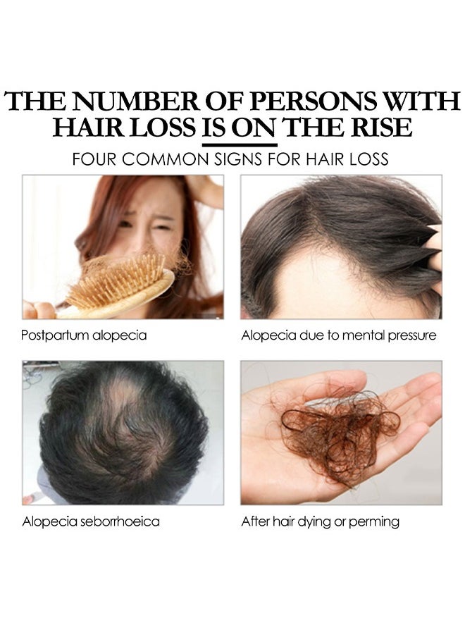 Batana Oil - Batana Oil For Hair Growth  - Batana Oil Organic for Healthy Hair - Repair Damaged Hair, Nourishes Thin Hair Scalp Skin and Loss Hair Growth Fir for All Hair Types - 30 ml