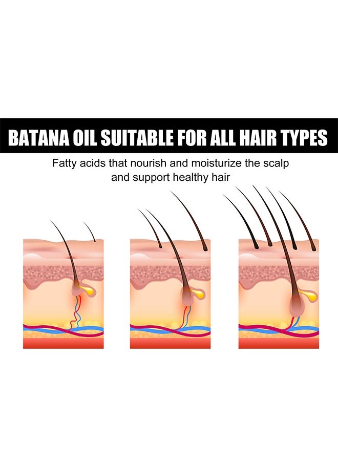 Batana Oil - Batana Oil For Hair Growth  - Batana Oil Organic for Healthy Hair - Repair Damaged Hair, Nourishes Thin Hair Scalp Skin and Loss Hair Growth Fir for All Hair Types - 30 ml