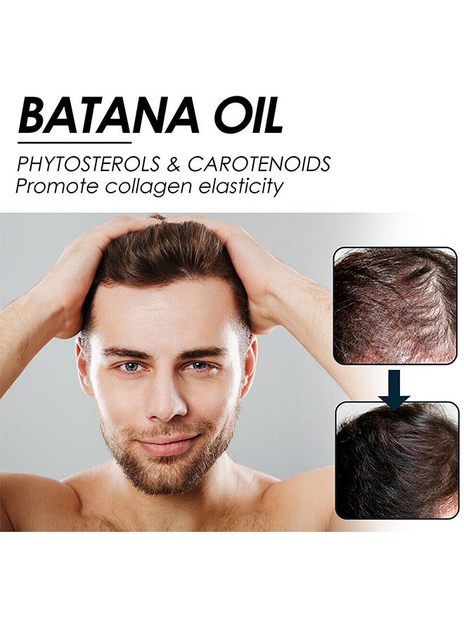 Batana Oil - Batana Oil For Hair Growth  - Batana Oil Organic for Healthy Hair - Repair Damaged Hair, Nourishes Thin Hair Scalp Skin and Loss Hair Growth Fir for All Hair Types - 30 ml