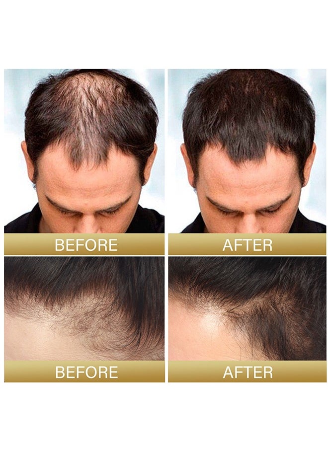 Batana Oil - Batana Oil For Hair Growth  - Batana Oil Organic for Healthy Hair - Repair Damaged Hair, Nourishes Thin Hair Scalp Skin and Loss Hair Growth Fir for All Hair Types - 30 ml