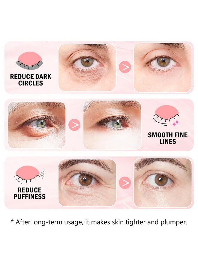Onespring Under Eye Patches (30 Pairs) 24K Gold Eye Mask and Hyaluronic Acid Eye Patches for Puffy Eyes, Rose Eye Masks for Dark Circles, Puffiness, Eye Bag, Wrinkles - Under Eye Skin Care