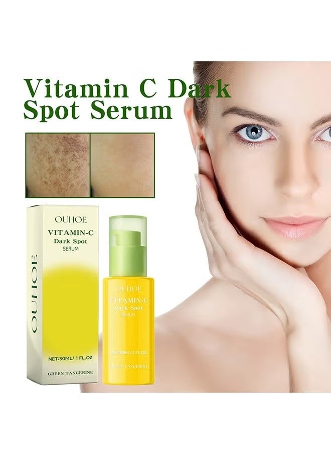 Green Tangerine Vitamin C Serum,Niacinamide acid Help Fade Sun Spots and Dark Spot,For Face & Neck and Eye Care Organic Anti-Aging Serum (30ml)