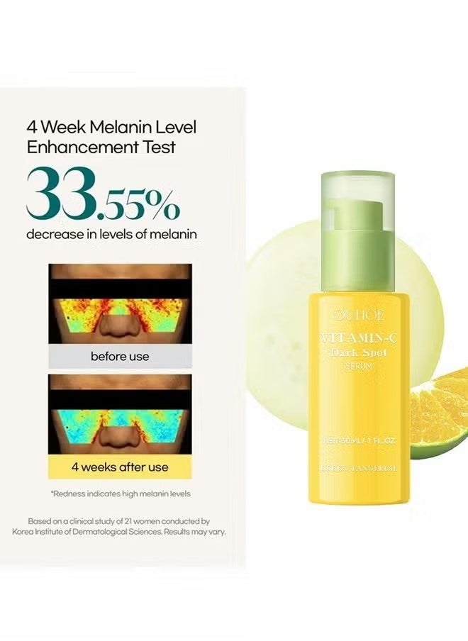 Green Tangerine Vitamin C Serum,Niacinamide acid Help Fade Sun Spots and Dark Spot,For Face & Neck and Eye Care Organic Anti-Aging Serum (30ml)