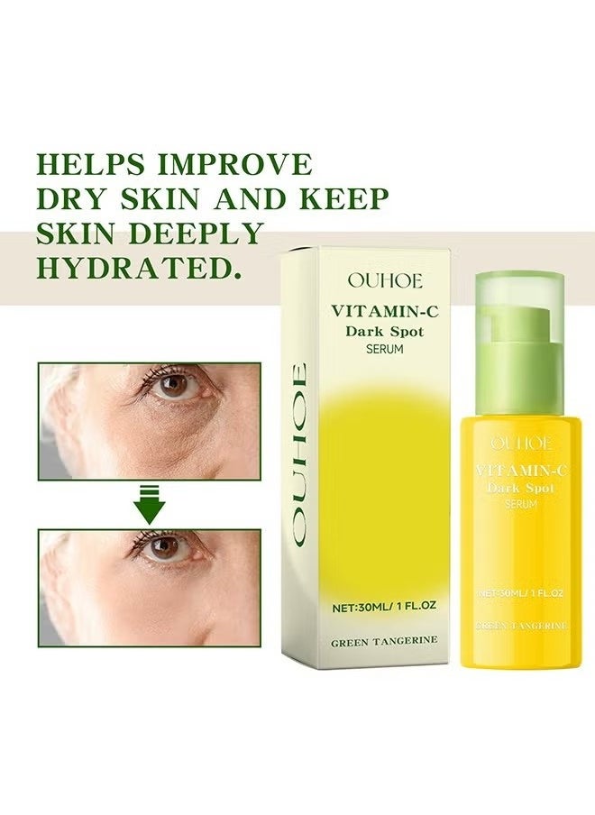 Green Tangerine Vitamin C Serum,Niacinamide acid Help Fade Sun Spots and Dark Spot,For Face & Neck and Eye Care Organic Anti-Aging Serum (30ml)