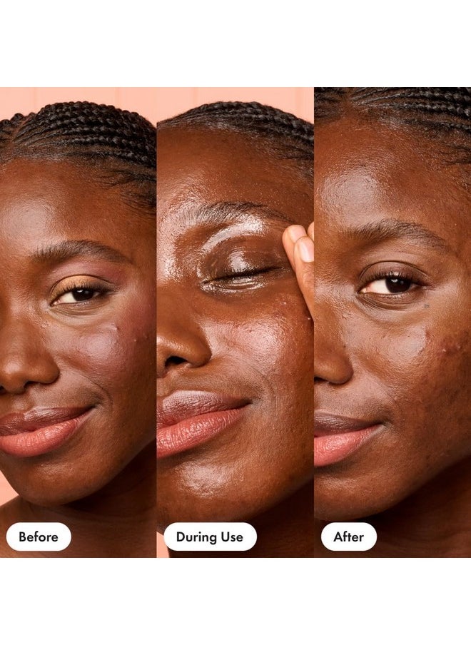 HERO COSMETICS Dissolve Away Daily Cleansing Balm - Helps Remove Makeup and Grime - Won’t Clog Pores - Suitable for Sensitive and Acne-Prone Skin (2.2 fl oz)