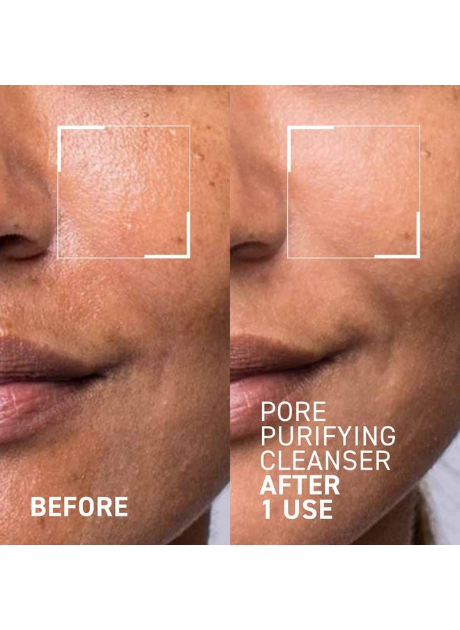 Dr. Brandt Skincare Pores No More Purifying Cleanser - Non-Drying Gel - Cleanses, Purifies, and Dissolves Excess Oil, Residue, and Debris - 3.5 fl oz / 105 ml