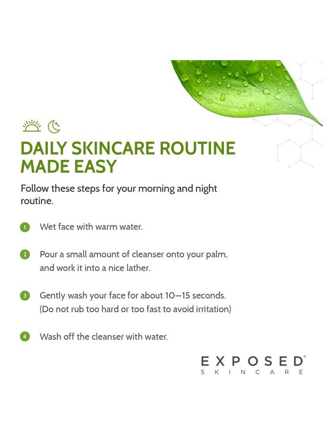 Exposed Skin Care Acne Facial Cleanser - Gentle Face Wash with Salicylic Acid for Acne Prone Skin - Pore Clarifying Acne Treatment for All Ages, Skin Types