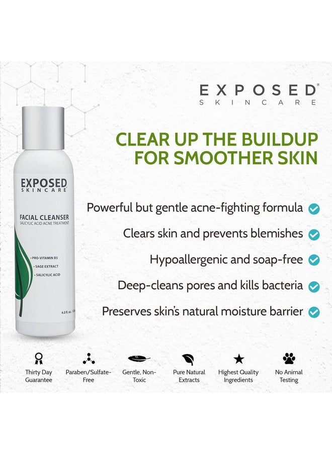 Exposed Skin Care Acne Facial Cleanser - Gentle Face Wash with Salicylic Acid for Acne Prone Skin - Pore Clarifying Acne Treatment for All Ages, Skin Types