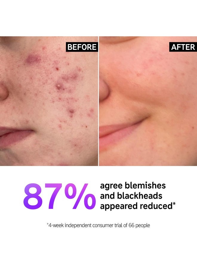 The INKEY List Salicylic Acid Cleanser, Face Wash for Blemishes, Blackheads, Oily Skin and Breakouts, Non-Drying Facial Cleanser Safe for All Skin Types, 5.0 fl oz