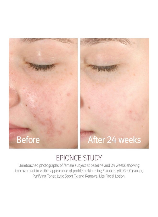 Epionce Lytic Gel Cleanser - Face Wash & Makeup Remover for Problem Skin, Face Wash for Oily Skin, Skin Care Cleanser Face Wash, Oily Skin Face Wash