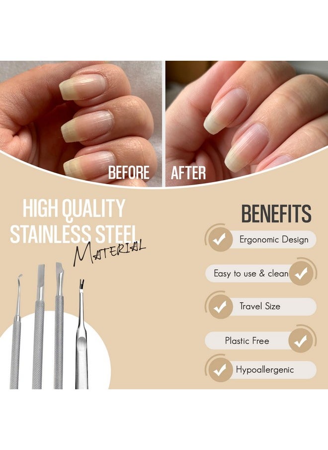 Cuticle Pusher Dual Sided - Sharp Edge Spoon Shaped Double Ended Ingrown Toenail Lifter Remover Trimmer Surgical Medical Grade Stainless Steel Manicure Pedicure Nail Art Care Tools (4 Pc Set) By Krisp