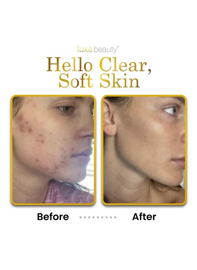 Luxe Cleanser All-in-One Hypoallergenic Face Cleanser + Natural Makeup Remover Face Wash + Exfoliator for All Skin Types - No Parabens, No Silicones - W/ Organic Botanicals: Thyme, Pineapple & Papaya
