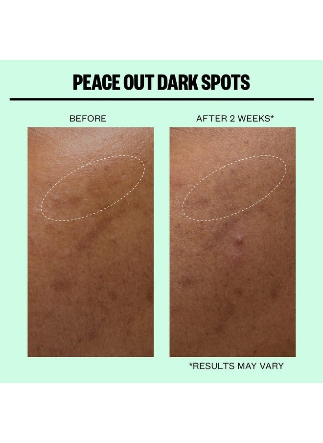 Peace Out Skincare Dark Spots. Dissolving Microstructure Dots to Reduce the Appearance of Dark Spots & Hyperpigmentation, Niacinamide Helps Reveal Clear, Even Skin (12 dots)