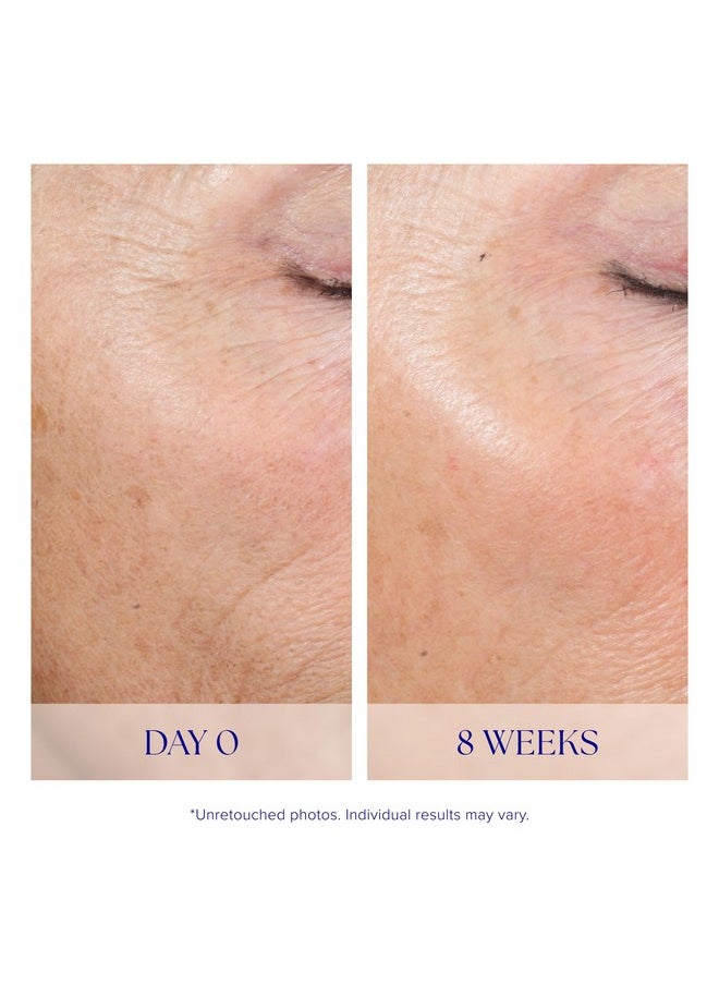 iS CLINICAL Active Peel System, two-step gentle at-home peel system for face Exfoliation