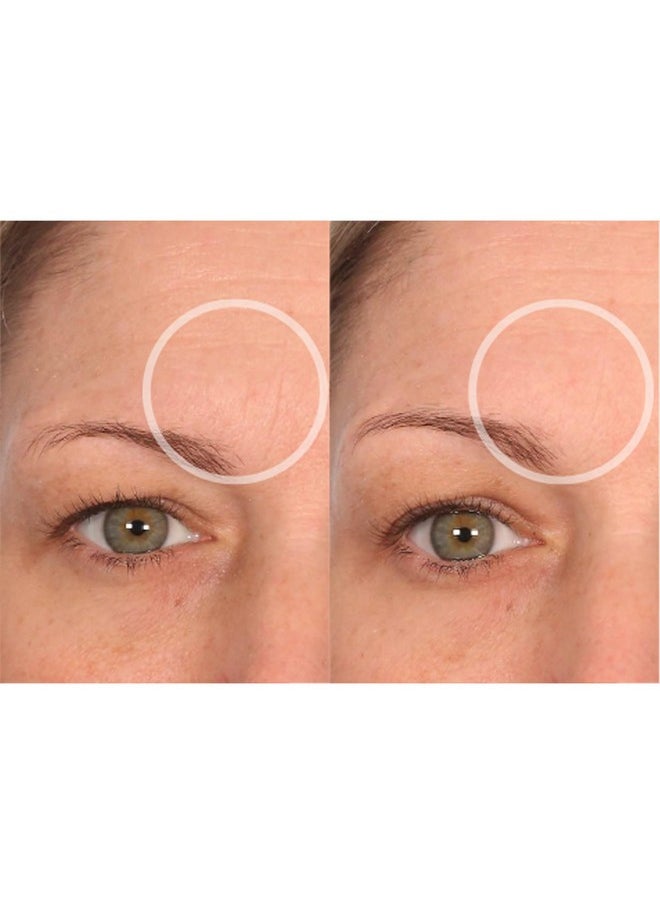 SiO Beauty FaceLift - Reusable Anti-Wrinkle Patches for Neck, Forehead, Eye & Smile - Overnight Smoothing Silicone for Fine Lines, Wrinkles, and Aging