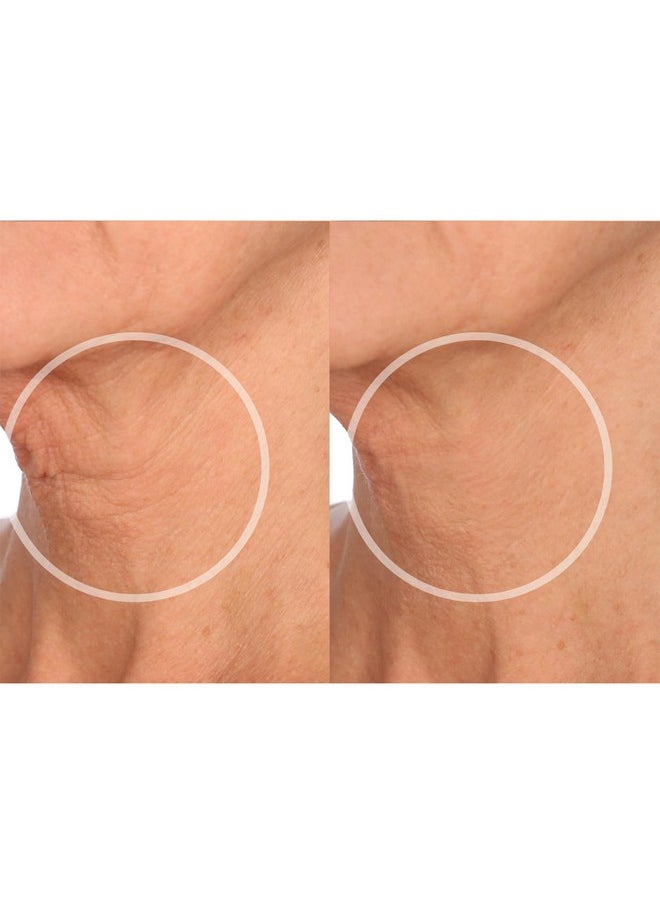 SiO Beauty FaceLift - Reusable Anti-Wrinkle Patches for Neck, Forehead, Eye & Smile - Overnight Smoothing Silicone for Fine Lines, Wrinkles, and Aging