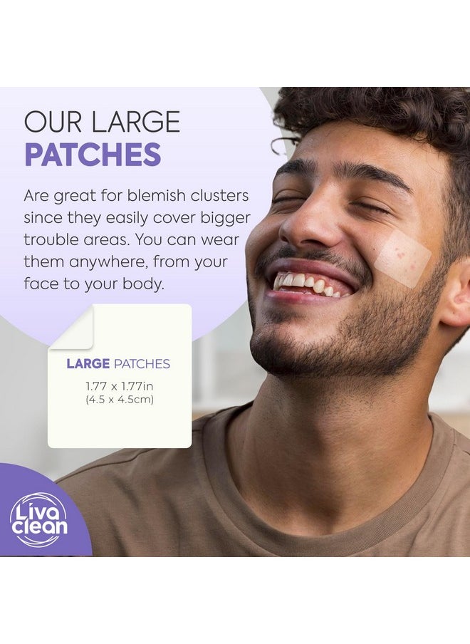 20 CT LivaClean Large Hydrocolloid Acne Patches - For Pore Spots Nose Face Cystic Pimple Zit Patch - Big Pimple Patches Hydrocolloid Bandages Strips Stickers Pimple Patch XL Large Acne Patch
