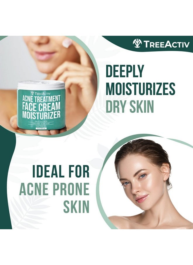 TreeActiv Salicylic Acid Face Moisturizer, 2 fl oz, Acne Treatment Face Cream for Oily Skin with and Tea Tree Oil, For Teens and Adults with Acne Prone Skin and Cystic Acne, 90 Day Supply