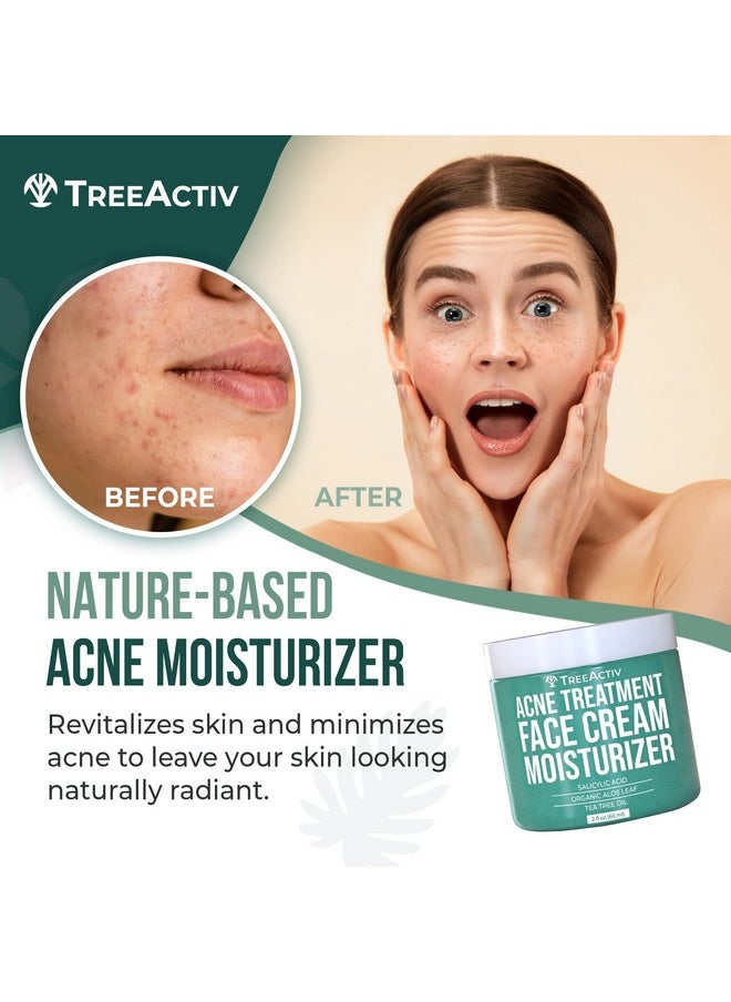 TreeActiv Salicylic Acid Face Moisturizer, 2 fl oz, Acne Treatment Face Cream for Oily Skin with and Tea Tree Oil, For Teens and Adults with Acne Prone Skin and Cystic Acne, 90 Day Supply