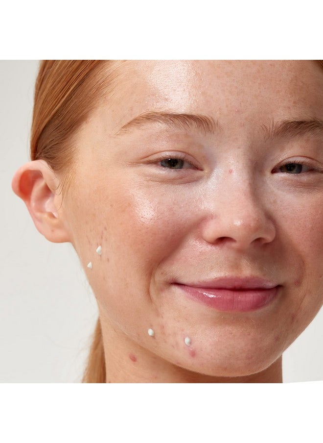 The INKEY List Succinic Acid Treatment, Helps Reduce Blemishes, Dead Skin Cells and Oil in Pores Without Causing Dry Skin, 1% Salicylic Acid, 0.50 fl oz