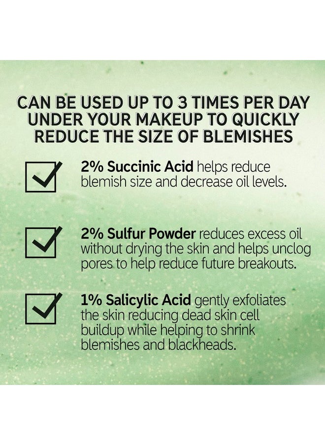 The INKEY List Succinic Acid Treatment, Helps Reduce Blemishes, Dead Skin Cells and Oil in Pores Without Causing Dry Skin, 1% Salicylic Acid, 0.50 fl oz