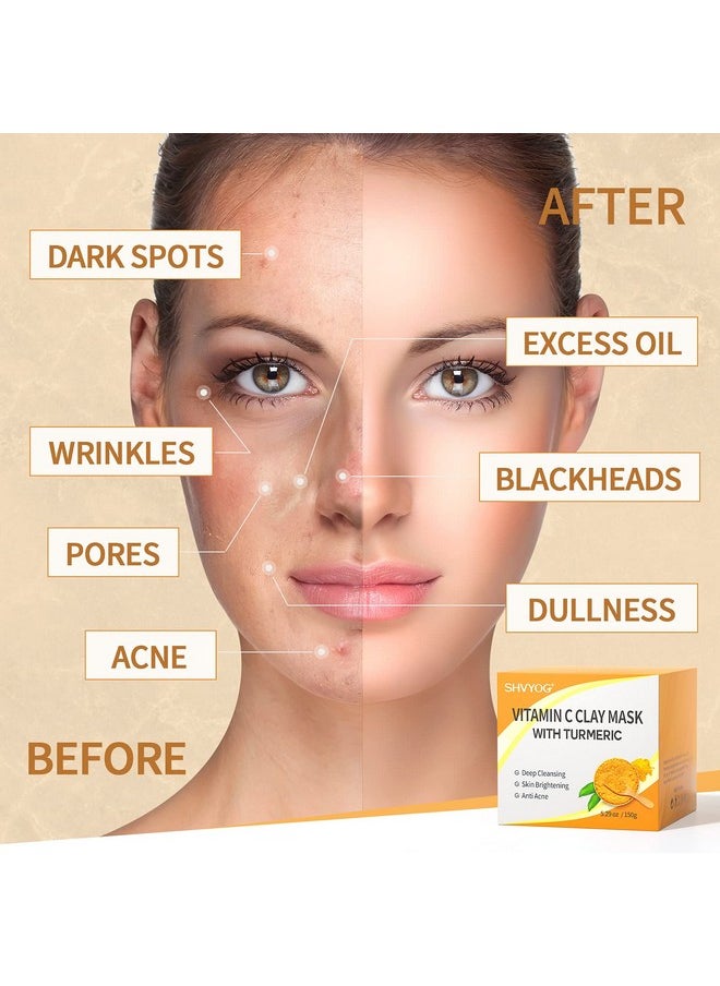 Vitamin C Face Mask with Kaolin Clay and Turmeric for Dark Spots, Dull Skin, Skincare Facial Mask for Controlling Oil and Refining Pores 5.29 Oz