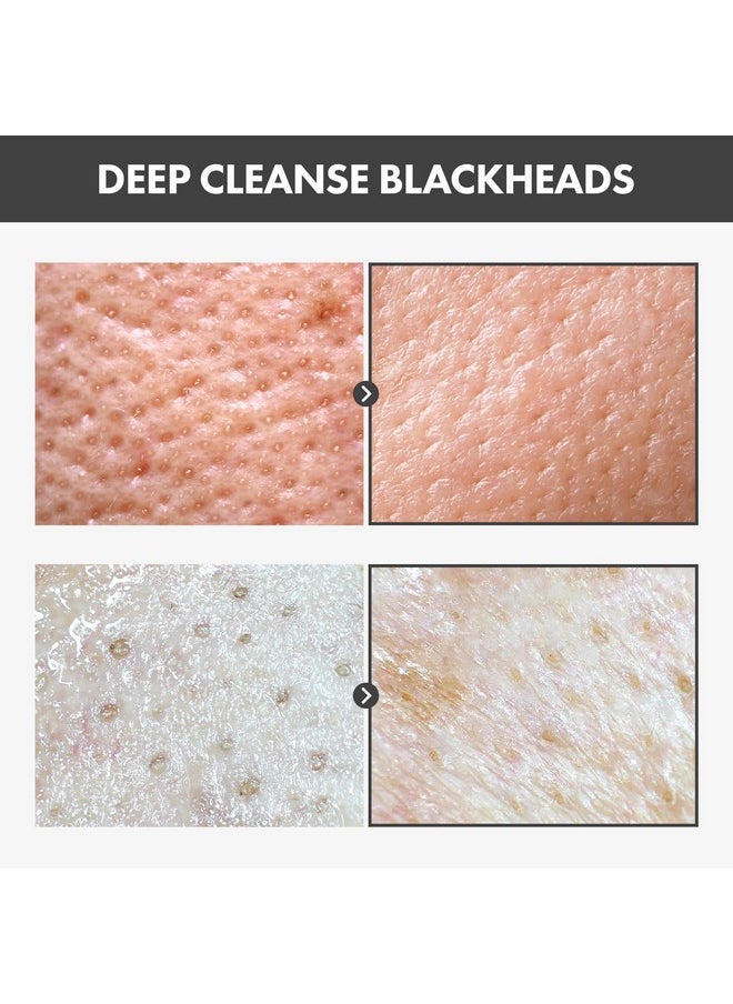 TOSOWOONG Blackhead Peel Off Pack, Charcoal Face Mask Peel Off for Blackheads and Pores, Deep Pore Cleansing, Pore Extractor Exfoliating mask, Korean Skincare, 50g, 1.76 oz.