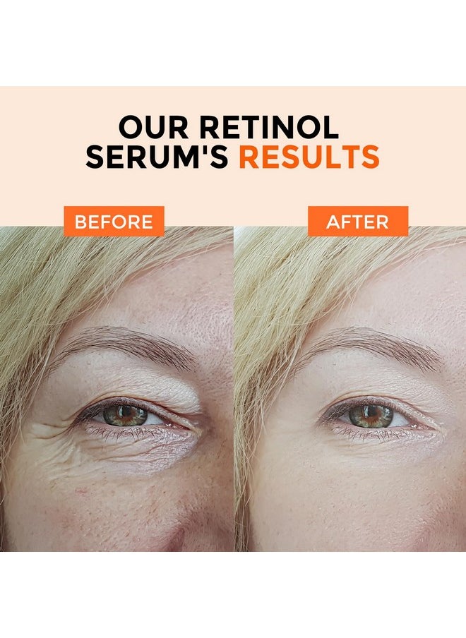 Retinol Serum for Face 2.5%, B5 Resurfacing Retinol Serum with Vitamin C, Vitamin E, Hyaluronic Acid, Niacinamide, Serum for Anti-Aging, Wrinkle Smoothing, Dark Spot Corrector, Brighten Dullness