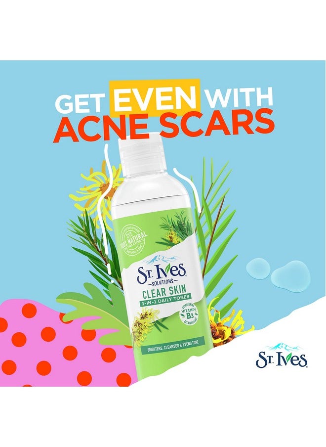 St.Ives Solutions 3-in-1 Face Toner For Combination to Oily and Acne Prone Skin Clear Skin Made with 100 percent Natural Tea Tree Extract, Vitamin B3, Micellar Water Technology, and Witch Hazel 8.5 oz