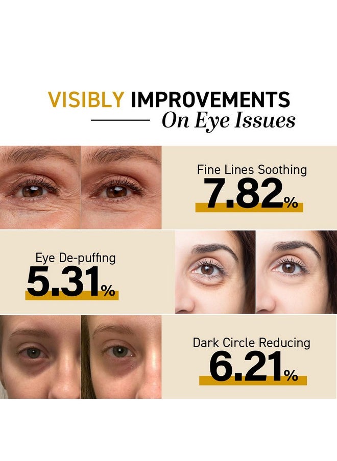 CITYGOO Eye Cream For Dark Circles: Eye Puffiness Under Eye Bags Treatment - Anti-Wrinkle (Snail Eye Stick 1 Count)