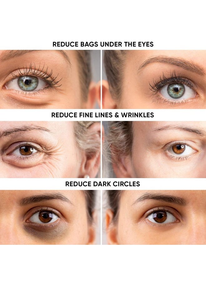 Instant Ageless Eye Cream - Reduces Under Eye Puffiness. Lift Technology to Tighten & Firm Sagging Skin Around Eyes. Works within Seconds. Smooths Away Fine Lines & Wrinkles for Men & Women.