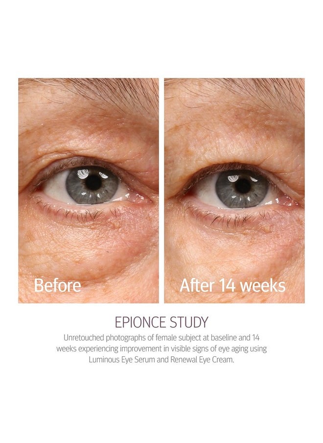 Epionce Renewal Eye Cream - Anti-Aging, Dark Circles & Puffiness, Hyaluronic Acid, Under Eye Brightener