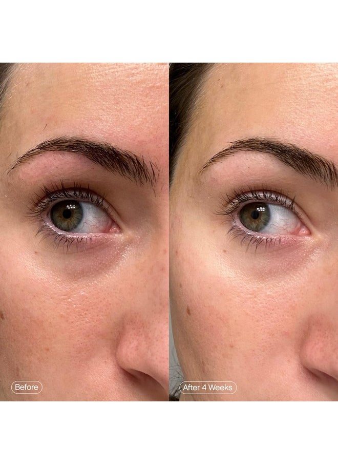 Topicals Faded Brightening Under Eye Masks | Patches to Depuff, Hydrate, Brighten and Cool | Reduce Dark Circles and Fine Lines | Contains Kojic Acid, Caffeine and Niacinamide (Set of 6)