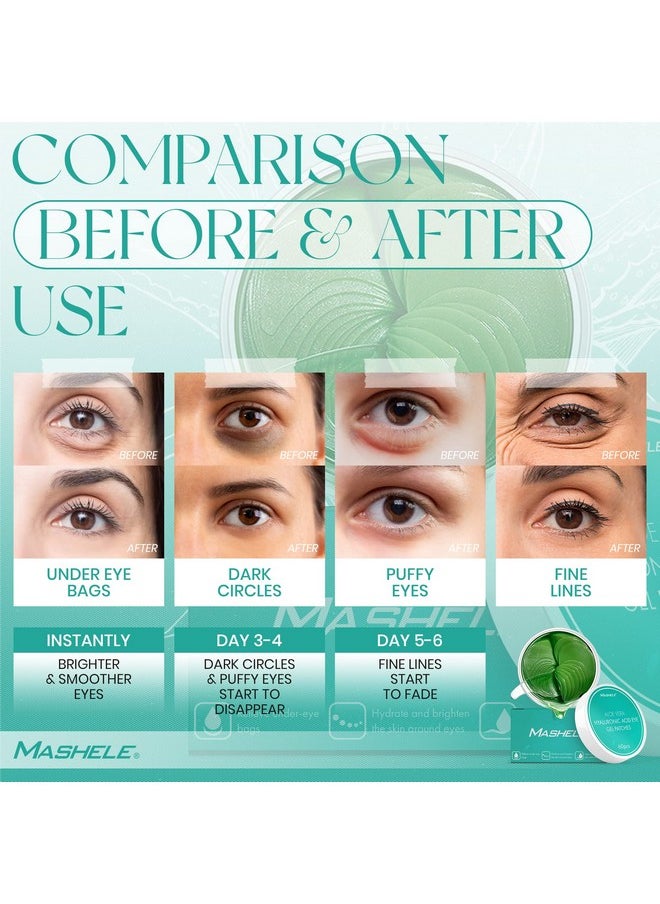 MASHELE Korean 60pcs Aloe Vera Collagen Under Eye Gel Patches Mask, Treatment for Puffy Eyes, Dark Circles, Anti Wrinkle Pads, Moisturizing for Women and Men (60pcs patches aloe vera)