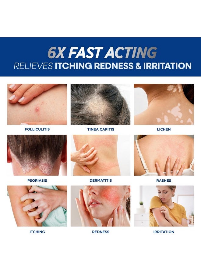 Folliculitis Treatment Cream: Effective Treatment for Folliculitis Scalp Face and Body 100g