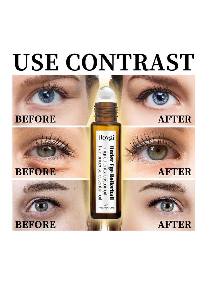 Eye Serum, Frankincense Eye Roller with Castor Oil for Dark Circles, Puffy Eyes, and Wrinkles, Anti Aging Eye Serum Cream, 0.34 Fl Oz