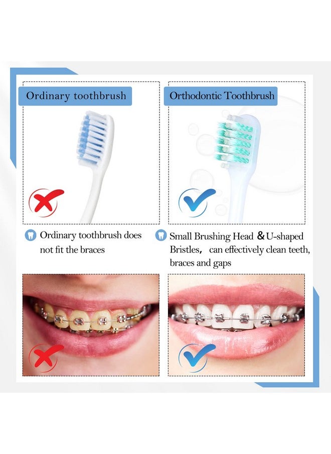 6 Pieces Brace Toothbrush V Shaped Orthodontic Toothbrush with Brush Head 40 Pieces Interdental Brush Soft Bristle Braces Brushes for Cleaning Portable Toothbrushes for Braces (Orange,Medium)