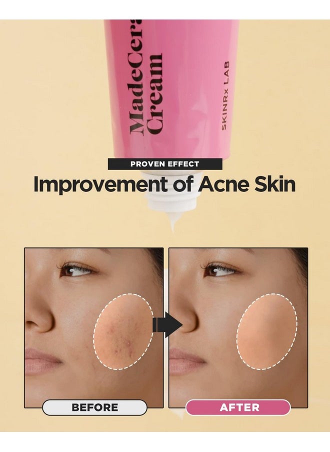 SKINRxLAB Made Cera Cream 50ml - Acne & Redness Relief, Sebum Control, Ceramide, Madecassoside, Anti-Aging, Pore Minimizing
