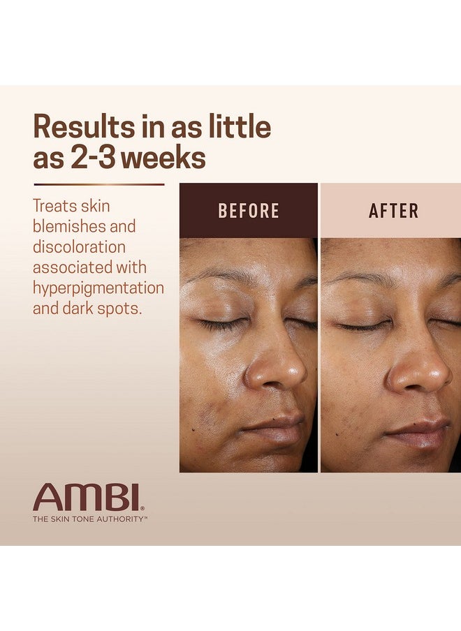 Ambi Even & Clear Fade Cream, Hydroquinone-free, Hyperpigmentation Treatment, Dark Spot Corrector, Results In As Little As 4 Weeks, Niacinamide, Aloe Vera, Vitamin C, 1 Fl Oz