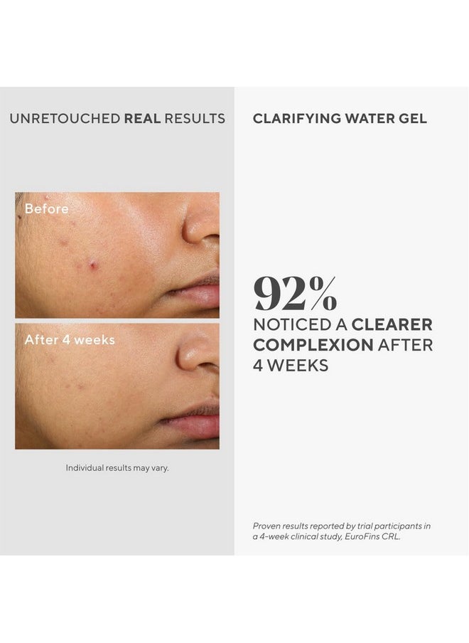 Murad Clarifying Water Gel - Non-Comedogenic Light Gel Moisturizer for Face, Neck & Chest - Facial Skin Care Product Hydrates with Non-Greasy Finish, 2 Fl Oz