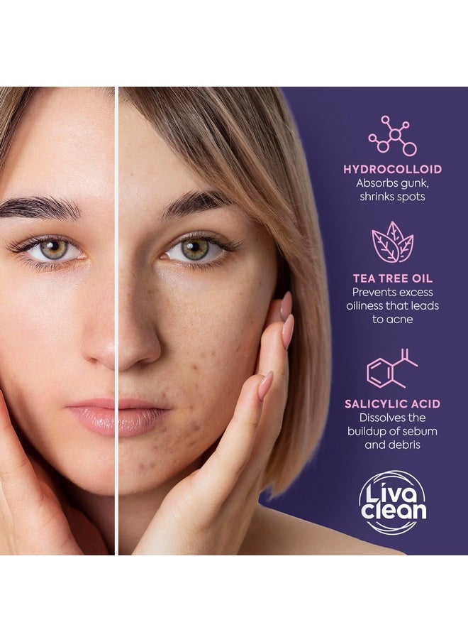 LivaClean Star Pimple Patches for Face w/Hydrocolloid, Salicylic Acid & Tea Tree | 240 Patches | Hydrocolloid Acne Patches, Cute Star Pimple Patches for Healing Stickers Zit Patch Superstar