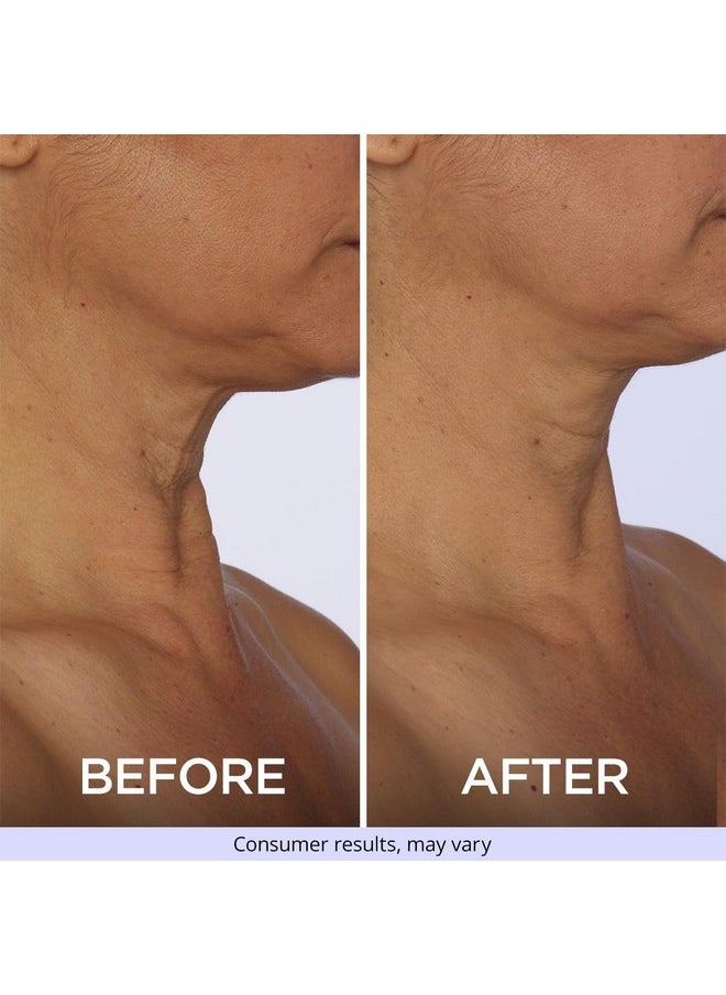 goPure Neck Firming Cream - Anti-Aging Neck Cream for Tightening and Wrinkles for an Even Skin Tone and Neck Lift - With Pro-Active Firming Complex, 1.7 oz