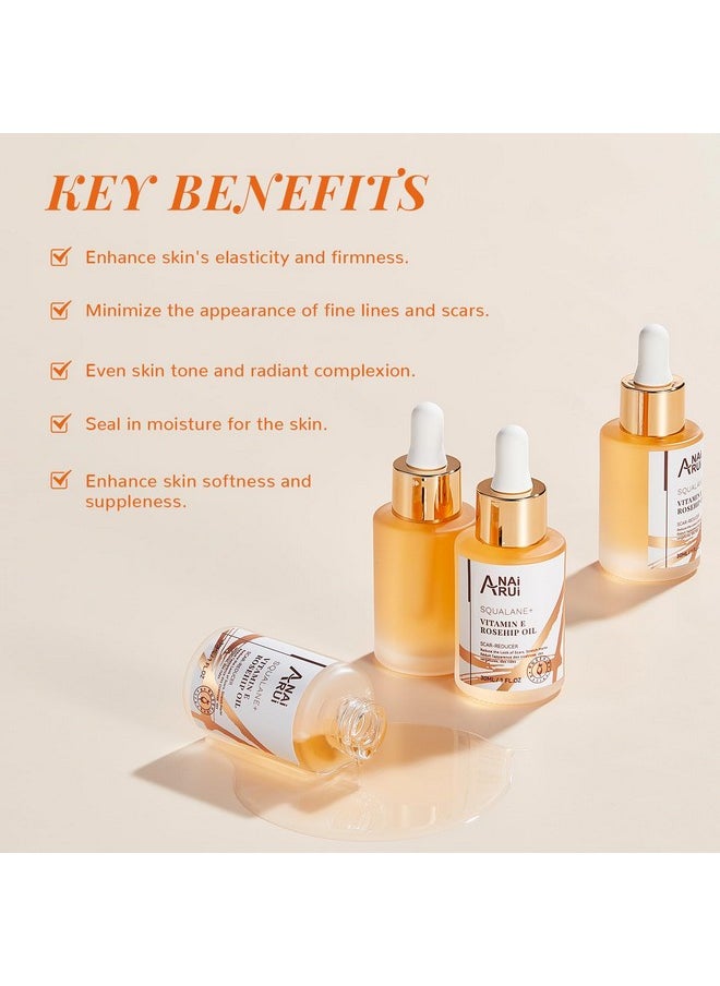 ANAI RUI Squalane + Vitamin E Rosehip Oil Moisturizer for Face Hydrate, Reduce Scars and Stretch Marks, Wrinkles for Smoother, Softer Skin 1 fl. Oz