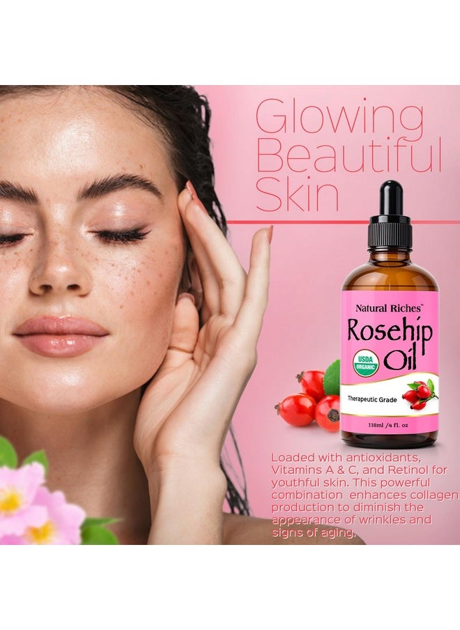 Natural Riches Organic Rosehip Seed Oil for Face 100% Pure Natural Cold Pressed Unrefined Non-GMO Carrier Oil for Skin Hair & Nails. 4 fl oz.