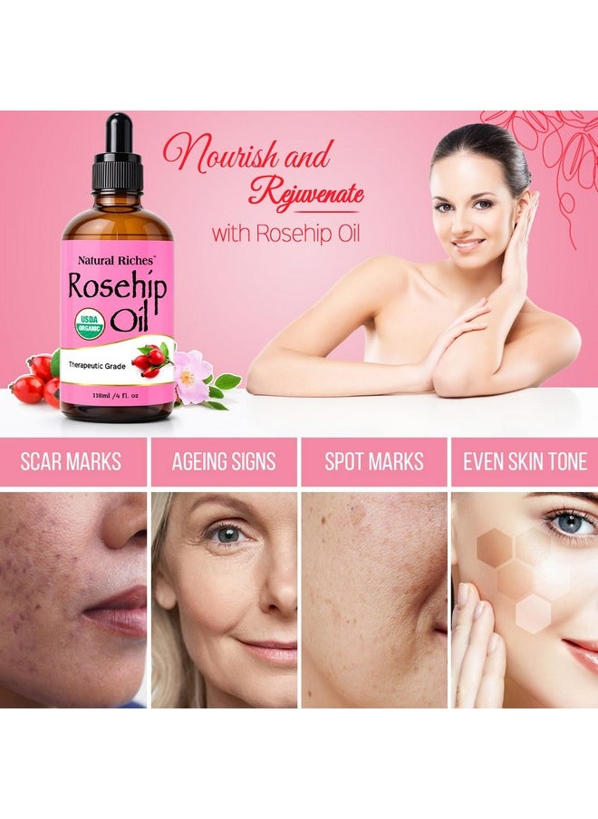 Natural Riches Organic Rosehip Seed Oil for Face 100% Pure Natural Cold Pressed Unrefined Non-GMO Carrier Oil for Skin Hair & Nails. 4 fl oz.