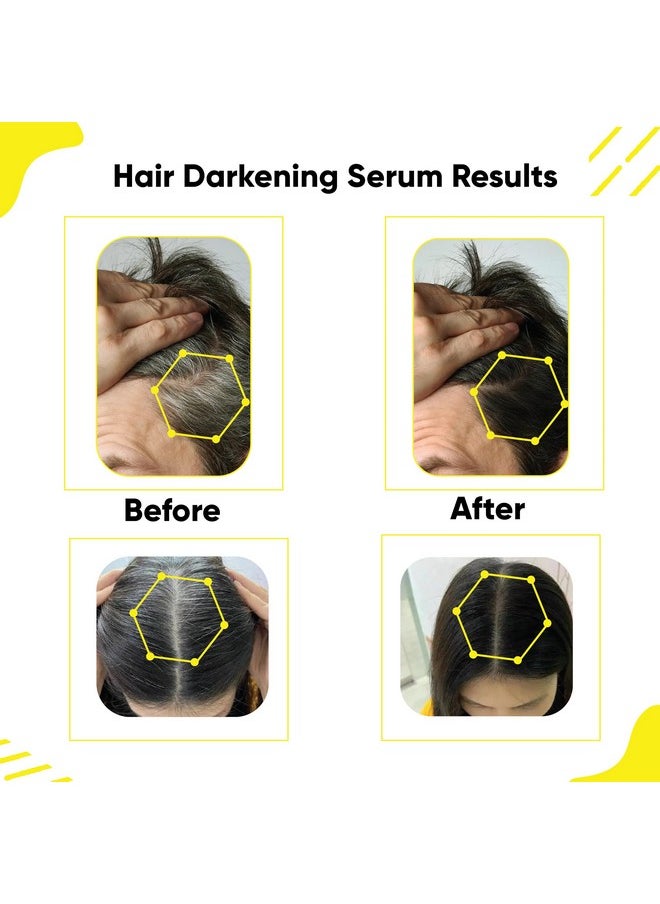 Masofta Anti Grey Hair Darkening Serum with Arcolys, Melano Gray, Biotin & Bhringraj For controlling Hair & Beard Greying, & Promoting Shinier Hair, For Both Men & Women, 30ML